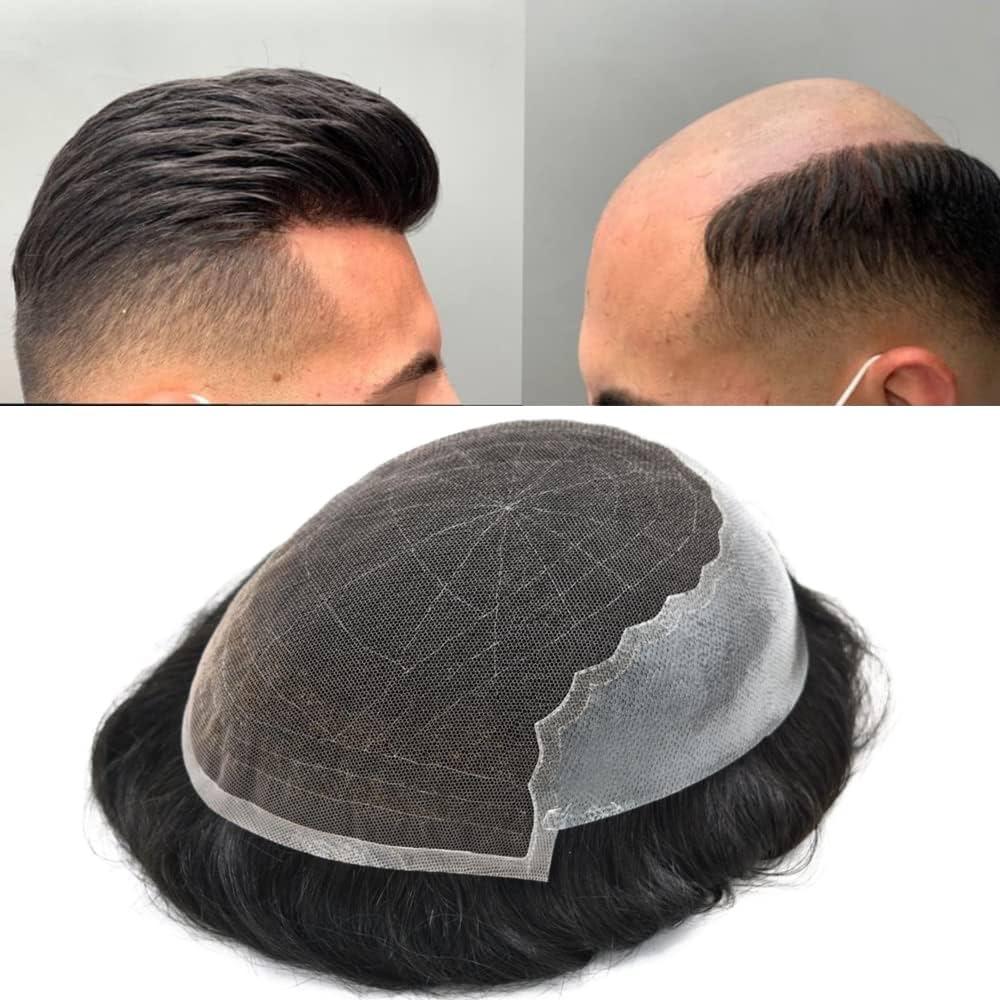 Hair Systems for Men